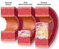 6a00e550081576883400e554b6b1708833